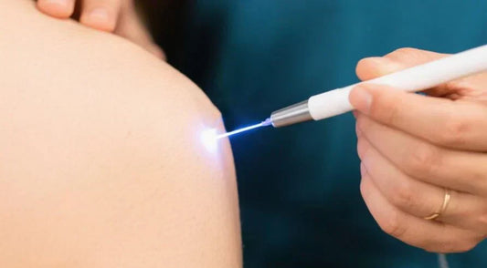 Understanding Laser Acupuncture