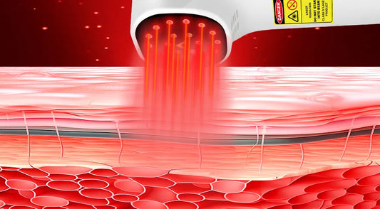 Optimal Power Output for Pre-Exercise Infrared Photobiomodulation Therapy (810nm) to Enhance Muscle Performance and Recovery