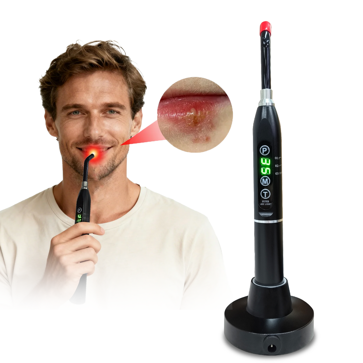 Portable Cold Sore Light Therapy Device Canker Sore Treatment Mouth Ulcer Relief