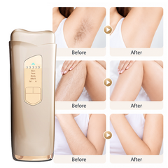 Ice‑Cool IPL Hair Removal Device, Painless Laser Hair Remover for Face, Body, Bikini Area, At‑Home Permanent Hair Removal Machine